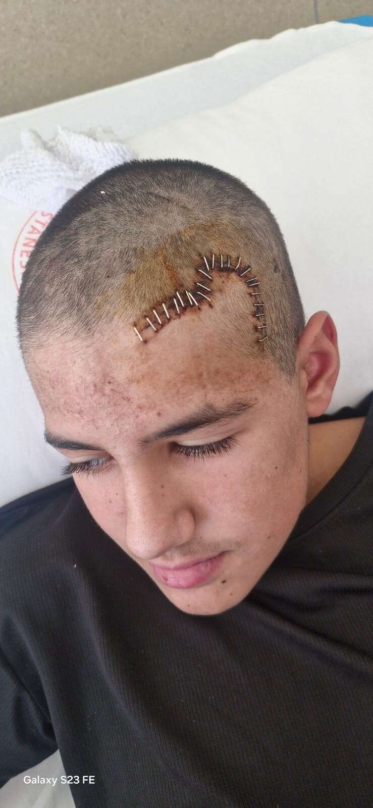 Konya’da kafatası parçalanan çocuk taburcu oldu, saldırgan “baba tahliye” paylaştı 5